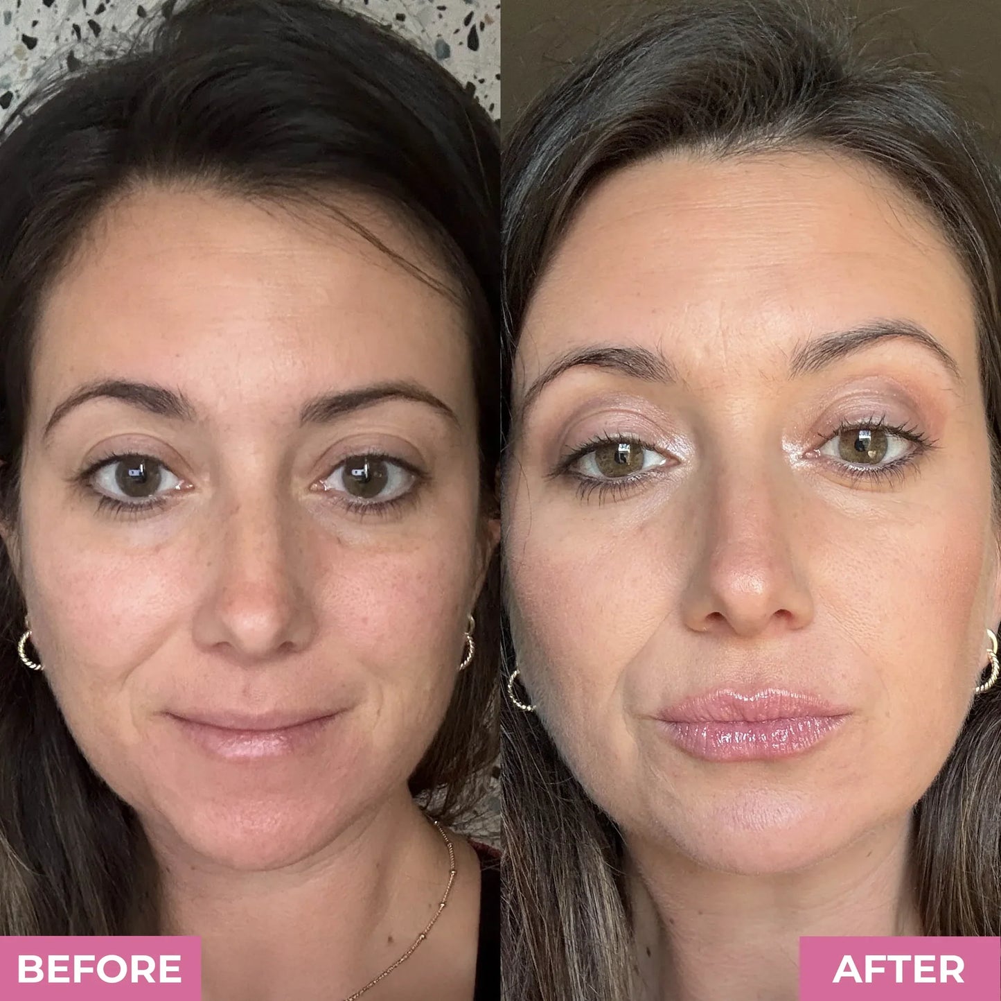 Melour™ Lip Plumper